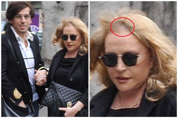 Мешок на голову - ещё лучше: облысевшая Пугачева без морщин на фото шокировала Сеть