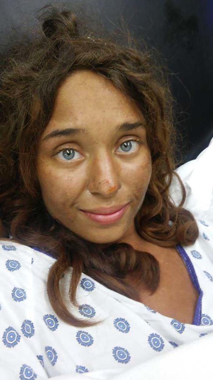 В США выжила девушка месяц блуждающая по лесу