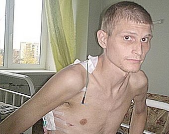 Мать умирающего десантника из Каменска-Уральского:«Военные отказываются спасать моего сына!»
