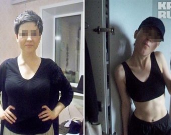 Девушка за год сбросила 26 кг, а теперь мучается от страшной болезни