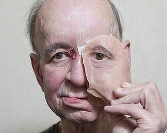 Мужчине напечатали новое лицо на 3D-принтере