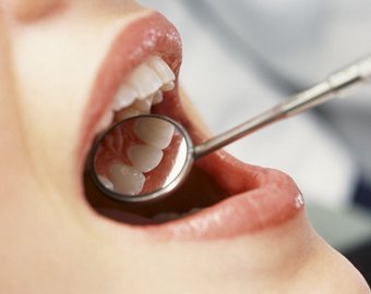 В ближайшие 10 лет ученые научатся выращивать зубы