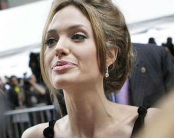 Стройна или больна? Почему Анжелина Джоли похудела до 35 кг