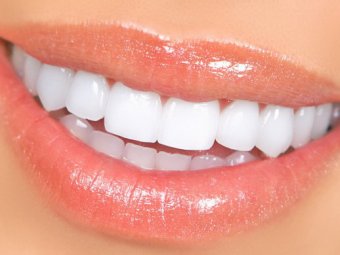 Имплантация зубов как самый комфортный вид протезирования