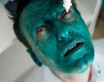 Огонь, зеленка, яйца и фекалии