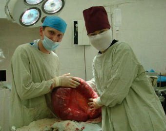 «Дело врача-убийцы»: хирург Ирина Цыбульская стала жертвой загадочного обвинения