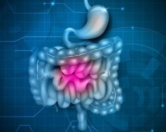 5 ВАЖНЫХ ШАГОВ К ТОМУ, ЧТОБЫ ИЗБЕЖАТЬ РАКА КИШЕЧНИКА