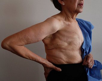 «Такой был страх, что лицо перекашивалось»