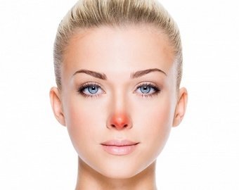 13 сигналов организма о болезнях, которые отражаются на нашем лице