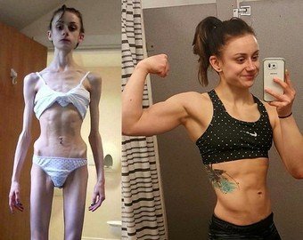 Анна Алексеева: «Мама просила не убивать себя»