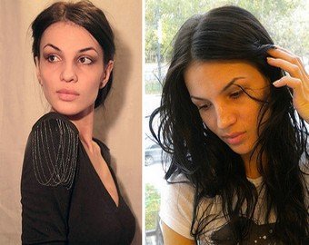 Сумасшедший врач или бракованные лекарства: Почему за две недели в клинике после пластических операций скончались три женщины