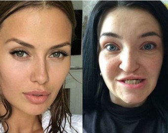 Виктория Боня отказалась помочь молодой матери с врожденным дефектом лица