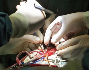 "Новорожденных оперировали вслепую, на свой страх и риск"