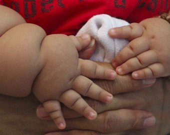 Мы вступили в новый век ожирения. Как это произошло? Вы удивитесь