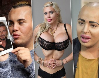 Фанаты, которые изуродовали себя, чтобы стать похожими на кумиров