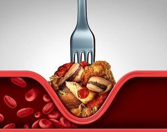 Прокачать мозги. Чем и как питаться, чтобы избежать старческого слабоумия