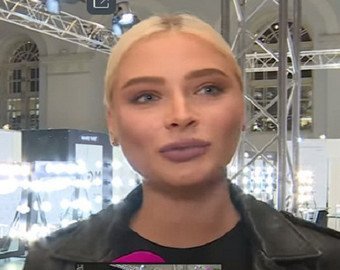 Пластический хирург об отеках на лице экс-невесты Тимати: «Банальная причина – это беременность»