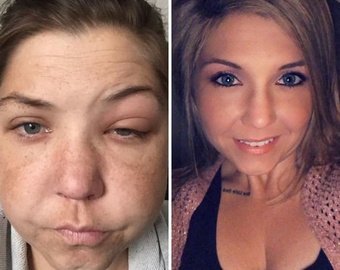 Как меняются люди, когда перестают пить: 10 отрезвляющих примеров