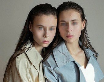 «Чтобы были видны скулы»: 14-летние модели-близняшки довели себя до анорексии