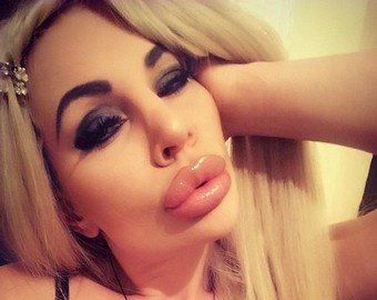 Жертва пластического хирурга удалила все снимки из соцсетей, чтобы ее не копировала новая подружка экс-жениха