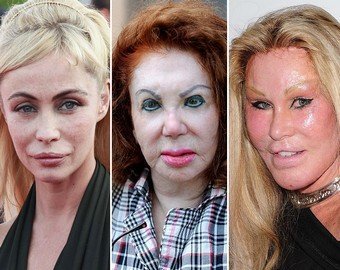 Жертвы красоты: кто заплатит за ошибку пластического хирурга