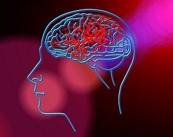 «Большинство людей даже не представляют, что инсульт – это навсегда»