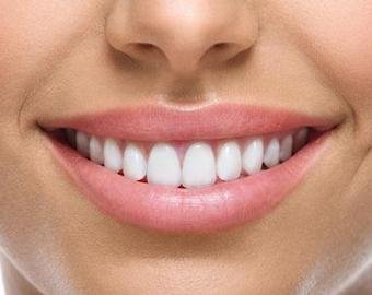 5 мифов и фактов об имплантации зубов — рассказывают стоматологи