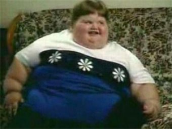 Самый толстый ребенок в мире похудел на 140 кг