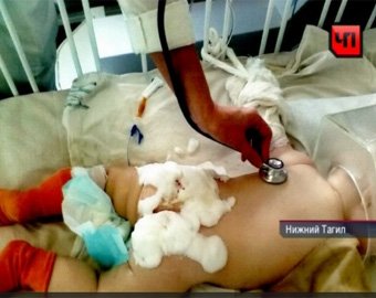 В Свердловской области 8-месячный ребенок получил ожоги при лечении в стационаре