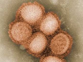 У 40% заболевших гриппом диагностирован «свиной грипп»