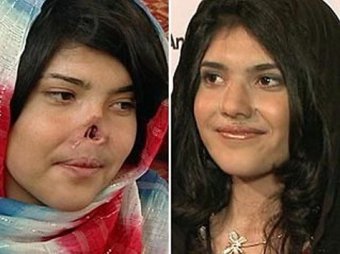 Снимок искалеченной талибами женщины без носа и ушей назван фотографией года