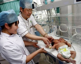 В Китае появился на свет двухголовый младенец