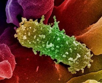 Во Франции зафиксирован первый случай смерти от бактерии E.coli