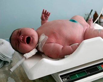 На Алтае родился гигнтский ребенок весом 7 килограммов!