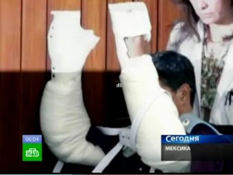 В Мексике врачи пересадили мужчине руки мёртвого мафиози