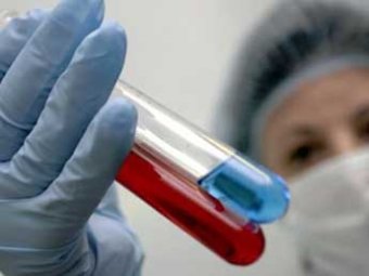 Ученые обнаружили тюлений грипп и испугались, что он может убить человечество