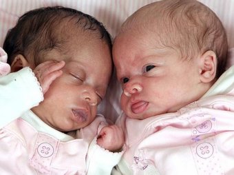 В Великобритании женщина родила "разноцветных" близнецов