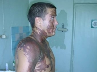 В Приморском крае солдат-срочник получил химические ожоги: его помыли в луже и заставили "ловить ветер"