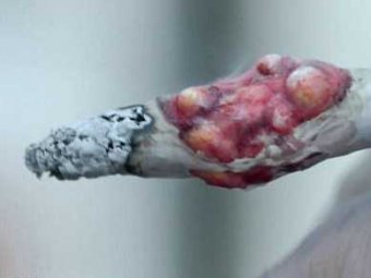 В Великобритании выпущен шокирующий видеролик, в котором сигареты болеют раком