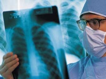 Ученые научились определять рак желудка по дыханию пациента