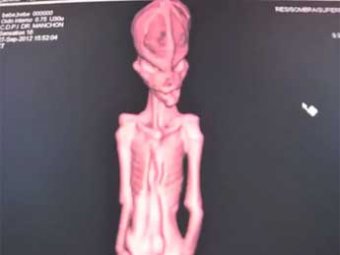 Ученые раскрыли тайну мумии инопланетянина из пустыни Атакама