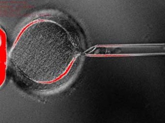 Ученые впервые клонировали эмбриональные клетки человека по методу "овечки Долли"