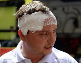 Избитый кавказцами депутат Худяков предложил сажать за хамство на 10 лет