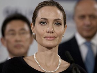 Врач Анджелины Джоли рассказала всю правду об операции