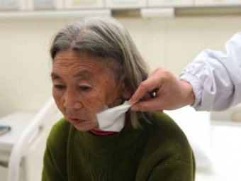 В лице китайской пенсионерки врачи нашли 12-сантиметровую бамбуковую палку