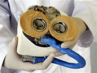 Врачи впервые вживили пациенту полностью автономное искусственное сердце