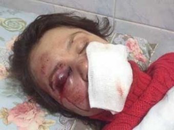 Избиение украинской журналистки привело к новым акциям протеста