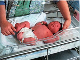 Во Владивостоке младенец захлебнулся рвотой во время рентгена