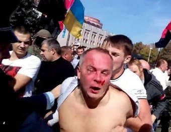 Новости Украины 30 сентября 2014: депутата Украины Шуфрича жестоко избили в Одессе