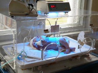 В Тульском роддоме из-за взрыва лампы фототерапии пострадали двое младенцев
